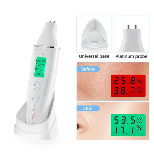BioSensor LCD Skin Moisture Tester: Precise Detector for Face Care and Beauty Spa – Women’s Beauty Tool - Payolie